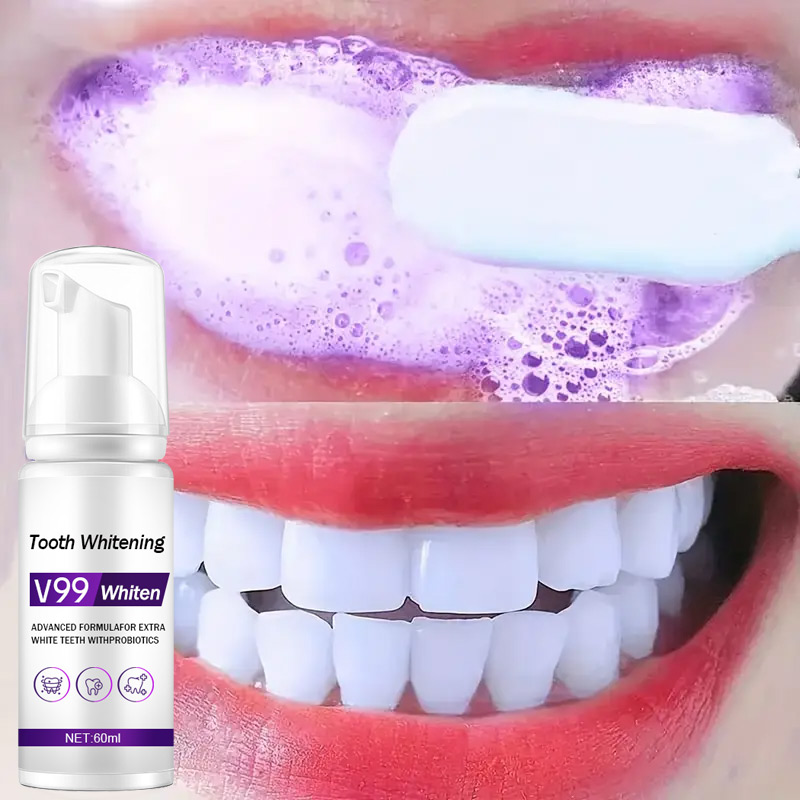 Mousse V99 pasta gigi pembersi - Teeth Whitening Mousse ulasan dan harga