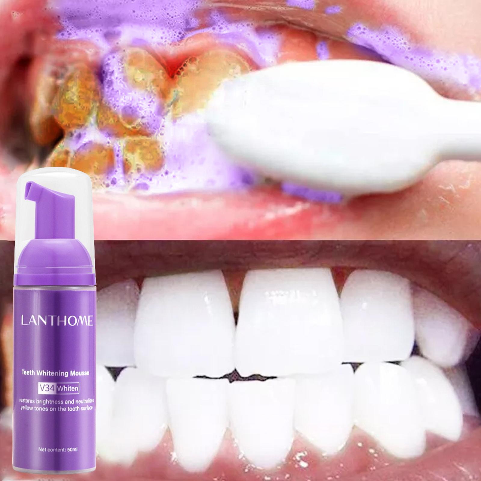 V34 pasta gigi Mousse efektif  - Teeth Whitening Mousse ulasan dan harga