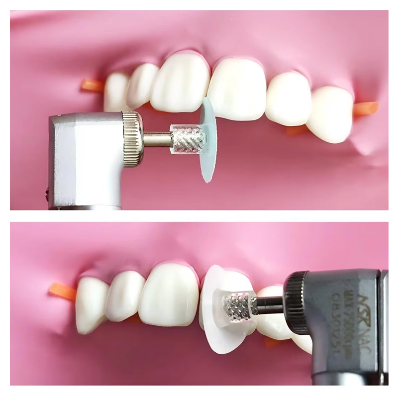 40Pcs Disc Poles Gigi Resin Ko - Teeth Whitening Home ulasan dan harga