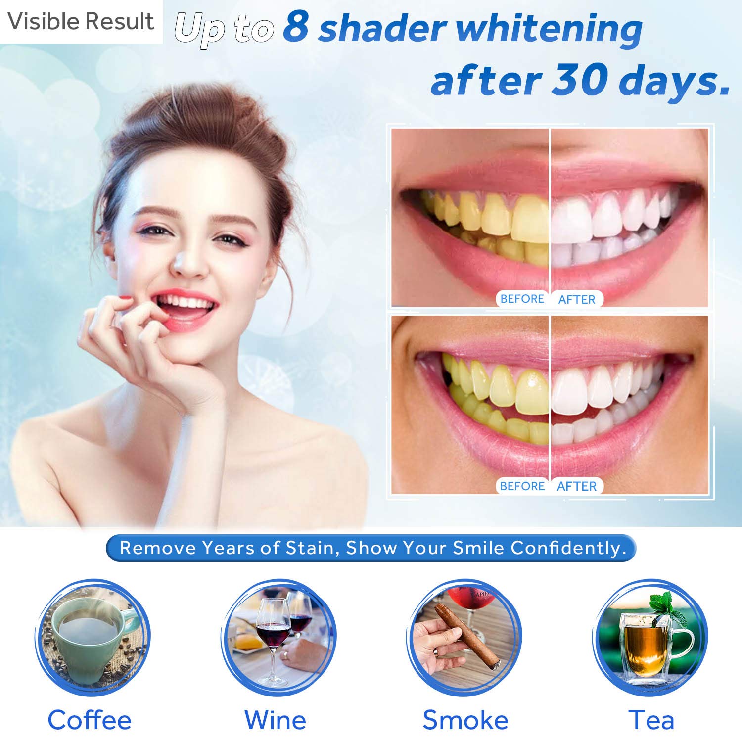 Gel Pemutih Gigi Isi Ulang Syr - Teeth Whitening At Home ulasan dan harga