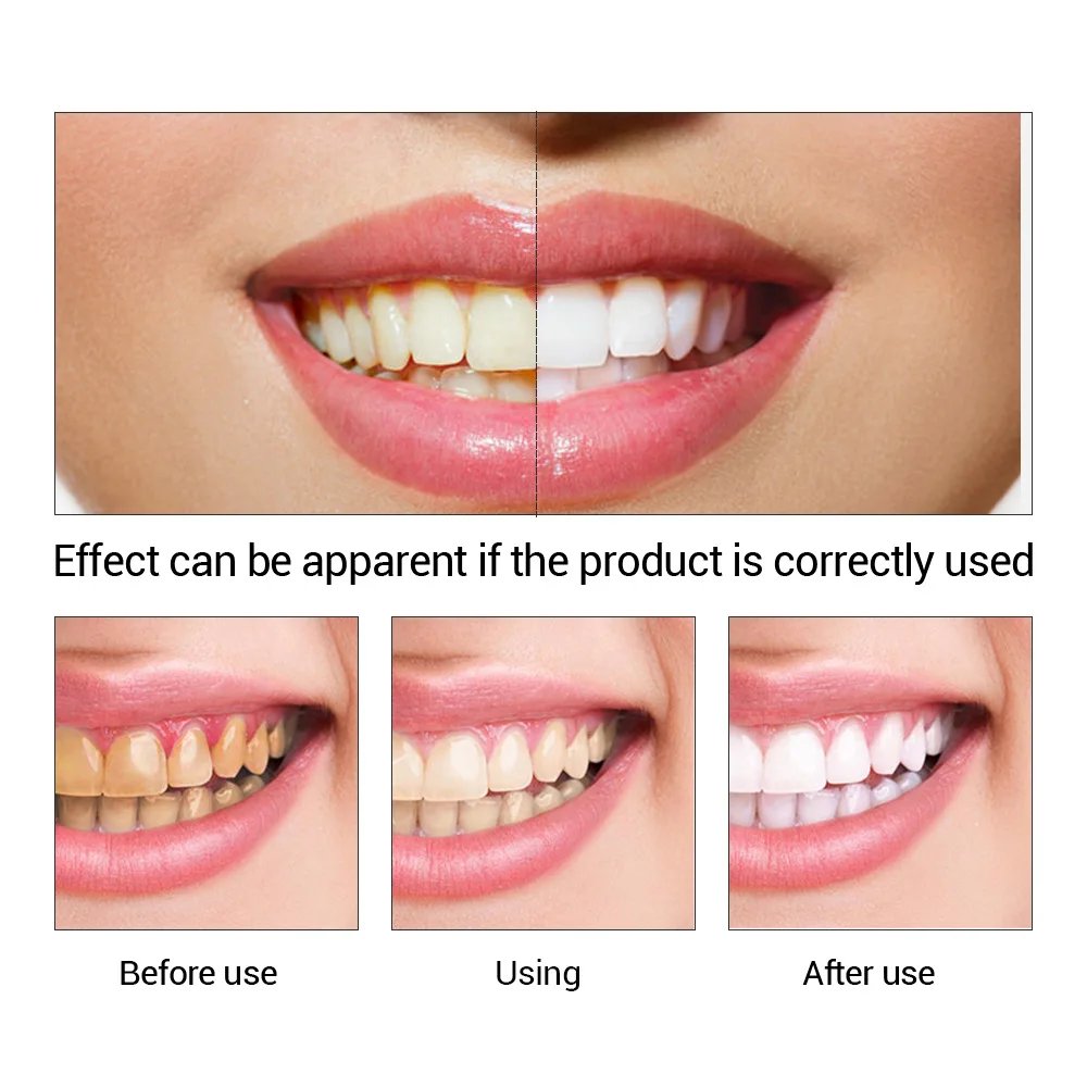 FTEENPLY Bubuk Esensi Pemutih  - Teeth Whitening At Home ulasan dan harga
