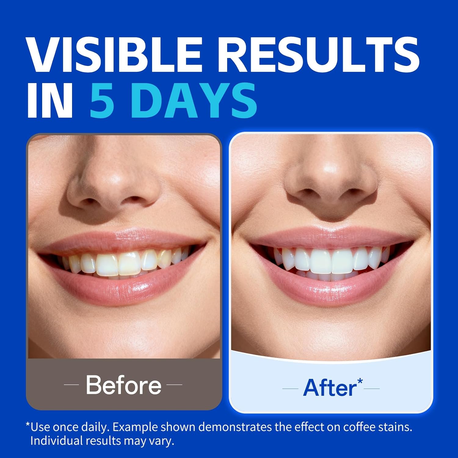 7 pasang Strip Pemutih Gigi un - Teeth Whitening Strips Crest ulasan dan harga