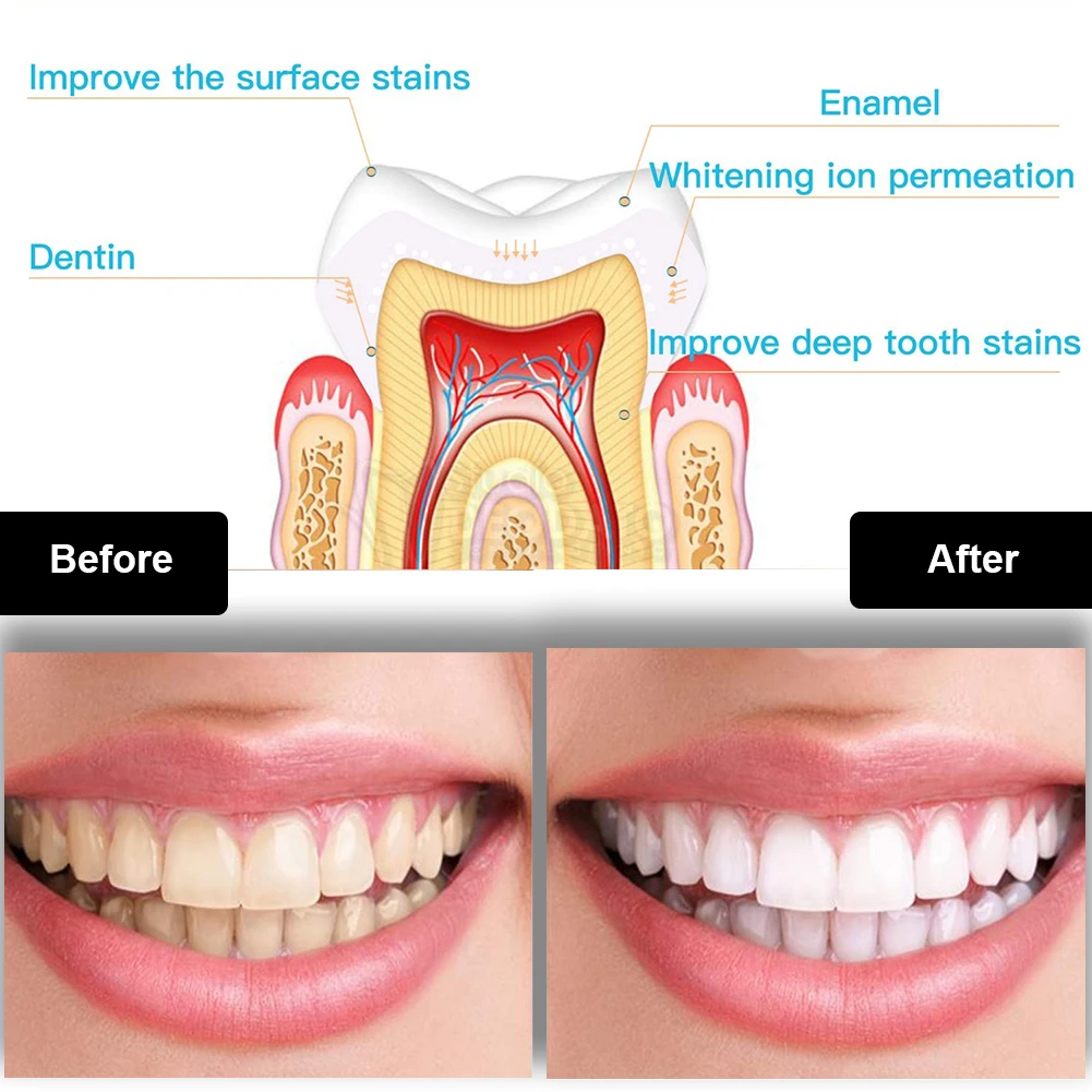 Kit pemutih gigi Mini 16 LED c - Teeth Whitening At Home ulasan dan harga