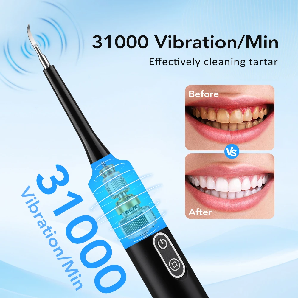 Alat Pembersih Karang Gigi Ele - Teeth Whitening Home ulasan dan harga